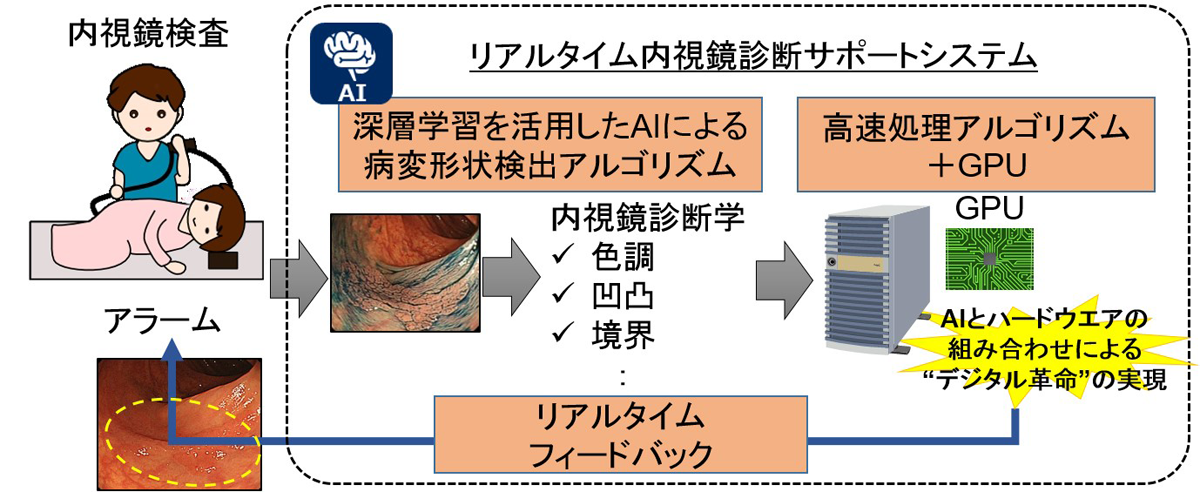 図　大腸内視鏡検査時に、検査画像をリアルタイムで解析して摘出すべき部分を検知して検査担当医に知らせる