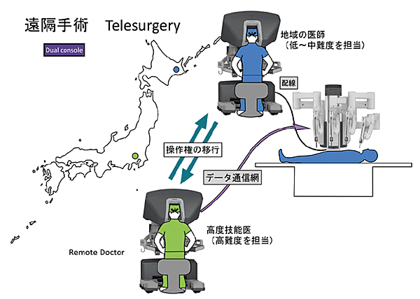 図4　遠隔手術のイメージ