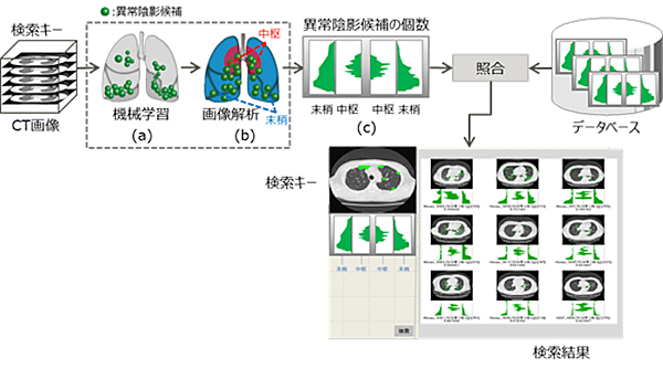 図　肺を末梢と中枢に自動的に分割し、それぞれの異常陰影の位置と数をヒストグラムにする