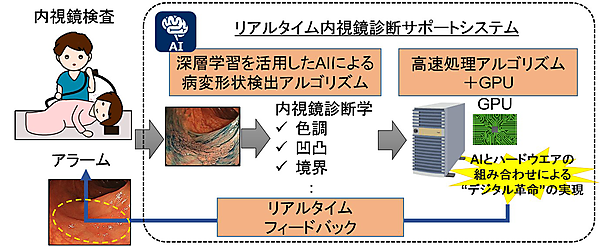 図　大腸内視鏡検査時に、検査画像をリアルタイムで解析して摘出すべき部分を検知して検査担当医に知らせる
